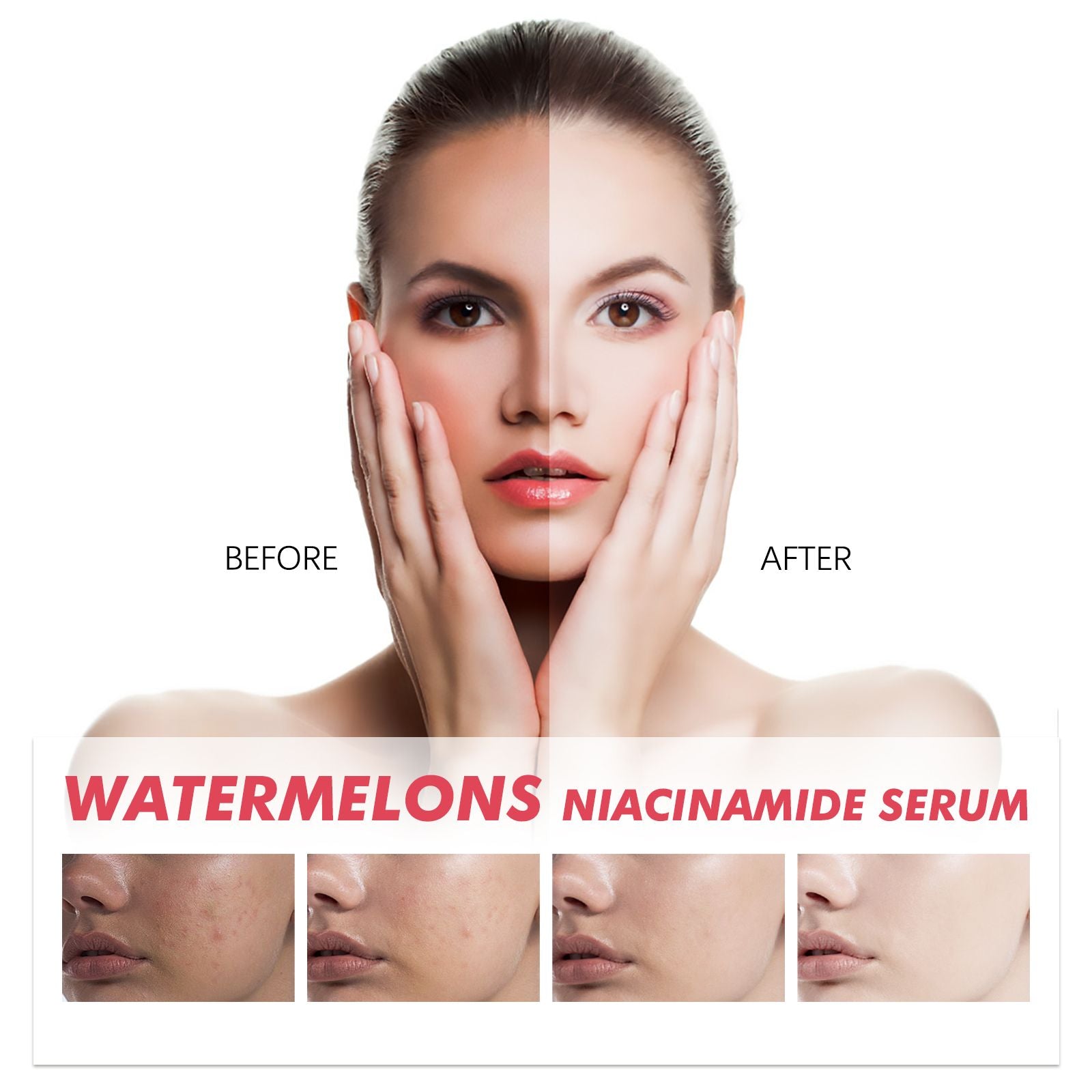 EELHOE Sérum à la Niacinamide de Pastèque, Estompe les Taches Raffermit et Illumine la Peau Hydratant Essence