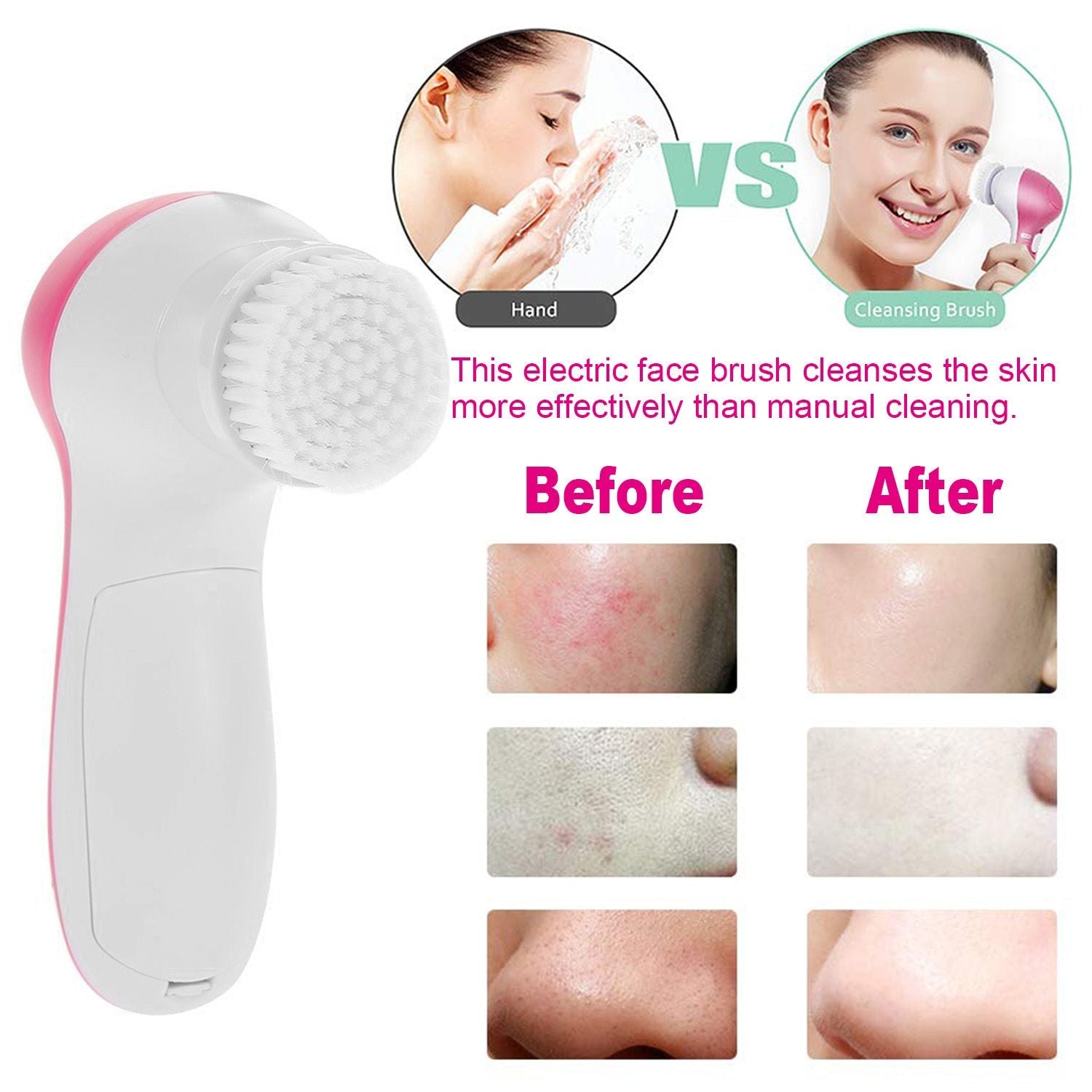 Brosse nettoyante visage électrique étanche avec 5 têtes de brosse pour femmes