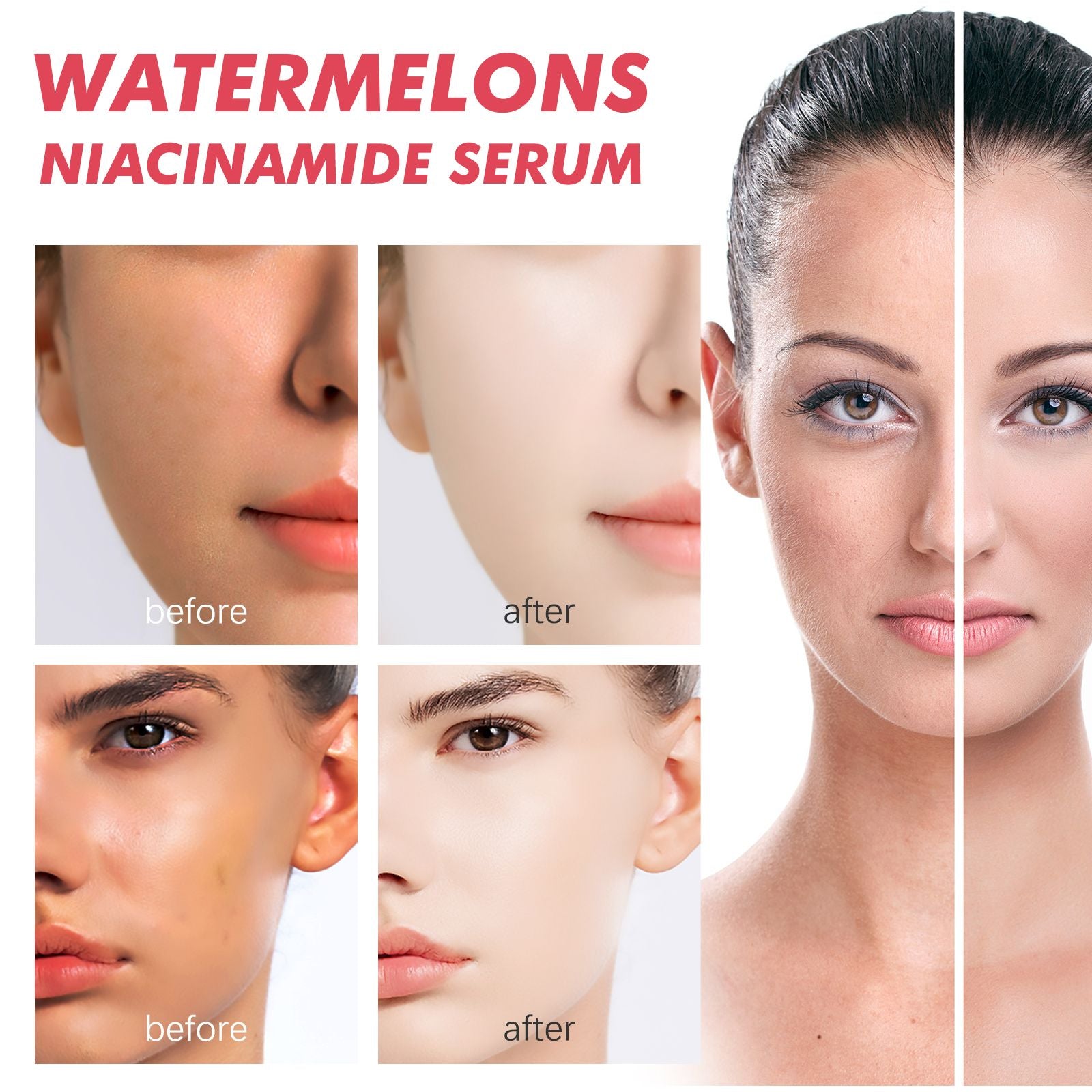 EELHOE Sérum à la Niacinamide de Pastèque, Estompe les Taches Raffermit et Illumine la Peau Hydratant Essence