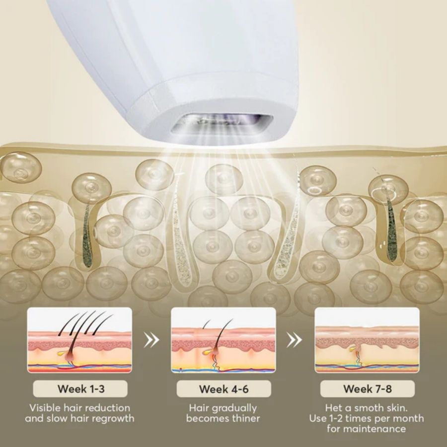 Professioneller Laser-Epilierer IPL-Haarentfernung Körper Bikini Bein Haarentfernungsgerät 900.000 Blitze 5 Stufen Epilierer Schmerzfreie elektrische Epiliermaschine